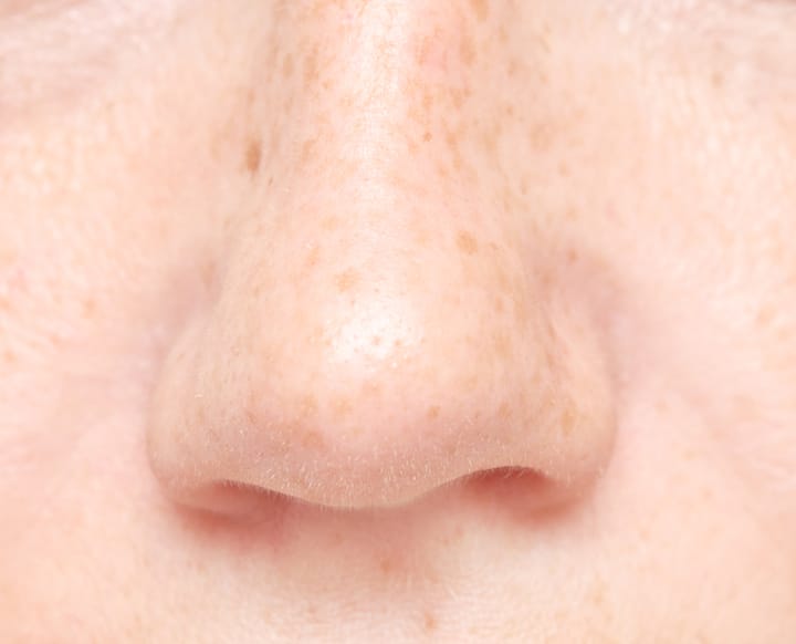Abhilfe gegen trockene Nase nach dem Winter - Mensvita
